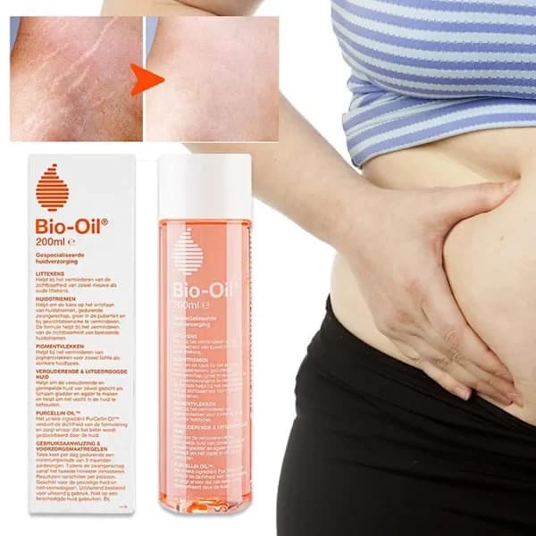 BioOil For Strekkmerker & Graviditetsstriper Paro Eterisk 200ml Baro Bio Eterisk